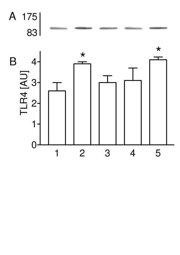 https://cdn.ncbi.nlm.nih.gov/pmc/blobs/ff34/1180473/fada8de8240f/1465-9921-6-51-2.jpg