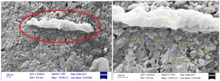 https://cdn.ncbi.nlm.nih.gov/pmc/blobs/ff37/7757976/c60a47a19996/ijpr-19-421-g002.jpg