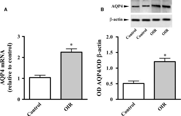 https://cdn.ncbi.nlm.nih.gov/pmc/blobs/ff44/5742711/44fab5427b7d/JCMM-22-613-g001.jpg