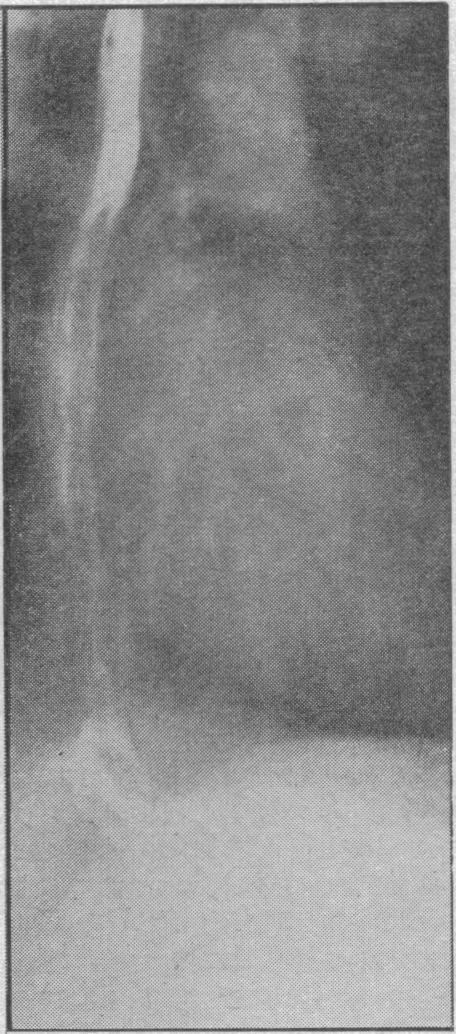 https://cdn.ncbi.nlm.nih.gov/pmc/blobs/ff47/1919057/fb2b06c6e1c0/procrsmed00394-0105-b.jpg