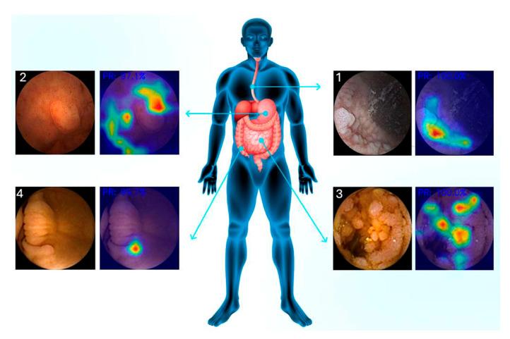 https://cdn.ncbi.nlm.nih.gov/pmc/blobs/ff49/11765989/eff854c98dca/jcm-14-00549-g002.jpg