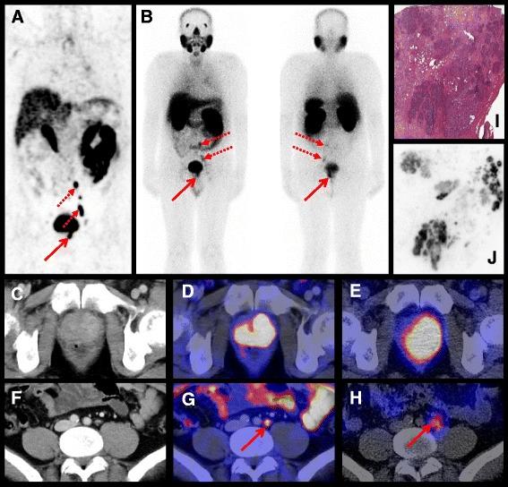 https://cdn.ncbi.nlm.nih.gov/pmc/blobs/ff59/4659791/645b5bcbe2ce/13550_2015_147_Fig3_HTML.jpg