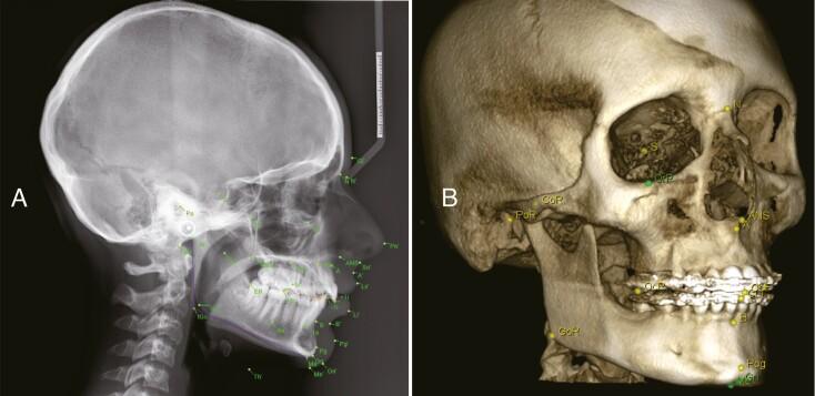 https://cdn.ncbi.nlm.nih.gov/pmc/blobs/ff5c/11185929/c72016964da8/cjae029_fig2.jpg