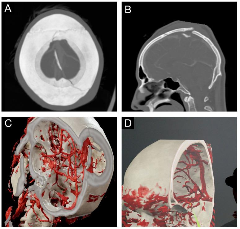 https://cdn.ncbi.nlm.nih.gov/pmc/blobs/ff5d/10608296/d01cea96026b/medicina-59-01720-g001.jpg