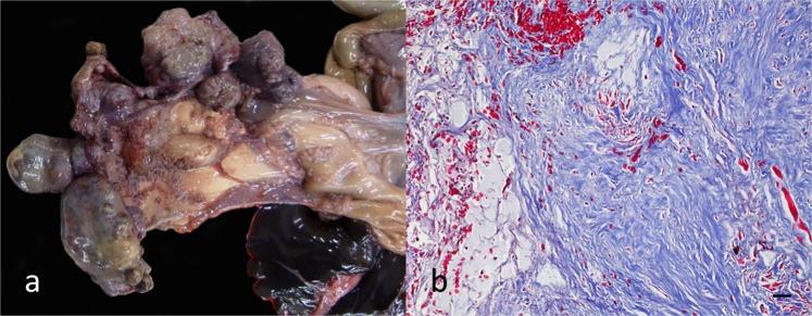 https://cdn.ncbi.nlm.nih.gov/pmc/blobs/ff5e/6877607/65eb306e642d/41598_2019_53970_Fig6_HTML.jpg