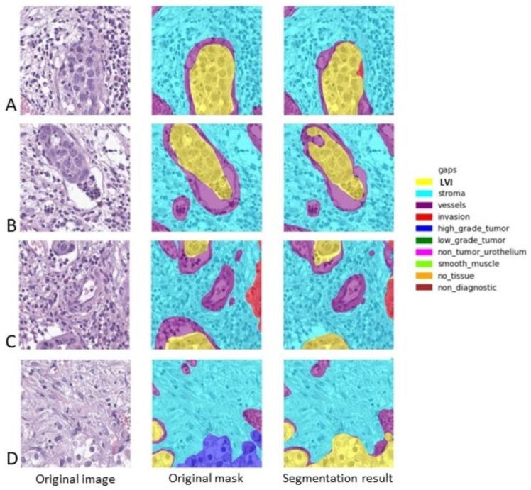 https://cdn.ncbi.nlm.nih.gov/pmc/blobs/ff67/10888137/3f5b4daad9e5/diagnostics-14-00432-g003.jpg
