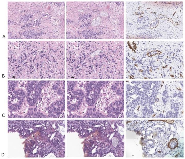 https://cdn.ncbi.nlm.nih.gov/pmc/blobs/ff67/10888137/61d8d25cf9d6/diagnostics-14-00432-g005.jpg