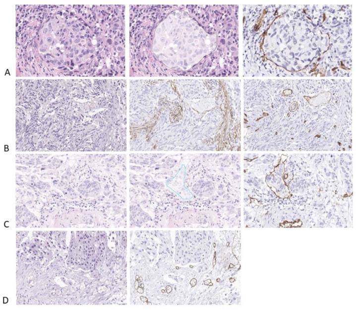 https://cdn.ncbi.nlm.nih.gov/pmc/blobs/ff67/10888137/aa0e9bbf03af/diagnostics-14-00432-g006.jpg