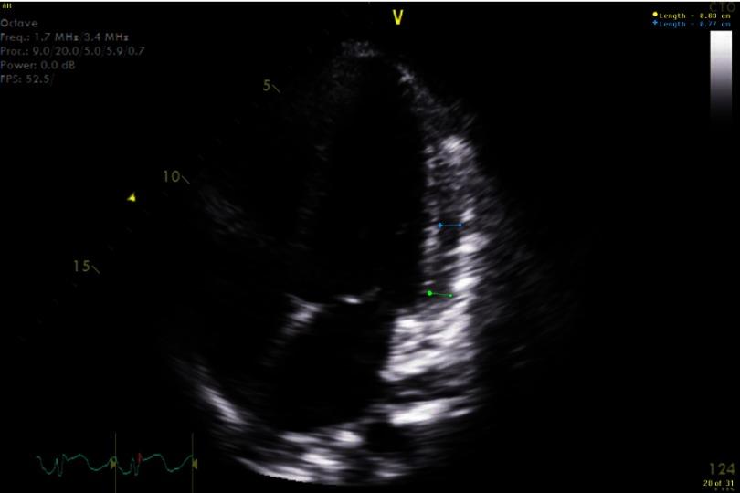 https://cdn.ncbi.nlm.nih.gov/pmc/blobs/ff6a/5621727/43619b252f04/gcsp-2017-1-e201708-g002.jpg