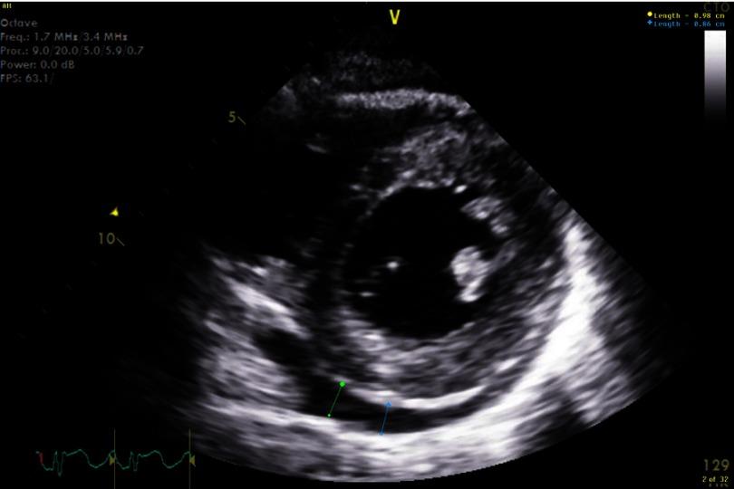 https://cdn.ncbi.nlm.nih.gov/pmc/blobs/ff6a/5621727/75b665444a2f/gcsp-2017-1-e201708-g004.jpg