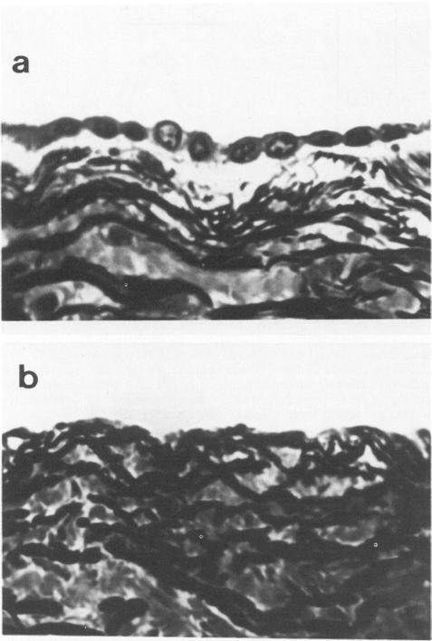 https://cdn.ncbi.nlm.nih.gov/pmc/blobs/ff70/1899612/d966b9ba8c9e/amjpathol00143-0106-a.jpg
