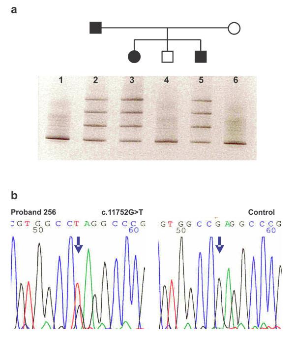 https://cdn.ncbi.nlm.nih.gov/pmc/blobs/ff76/2736583/b9a3172ea05a/1471-2350-10-78-1.jpg