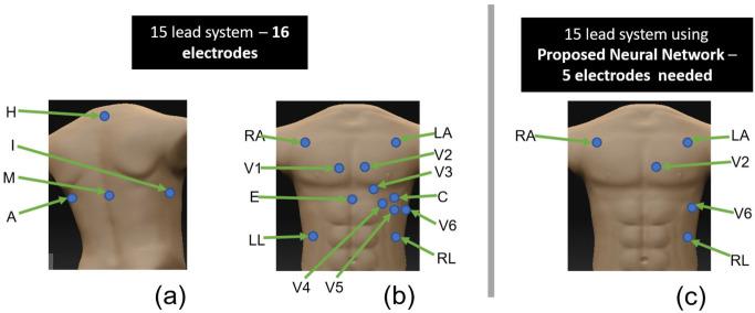 https://cdn.ncbi.nlm.nih.gov/pmc/blobs/ff7a/9920327/bc0e2178537d/sensors-23-01389-g001.jpg