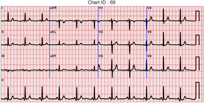 https://cdn.ncbi.nlm.nih.gov/pmc/blobs/ff7a/9920327/d4ca44bb0391/sensors-23-01389-g002.jpg