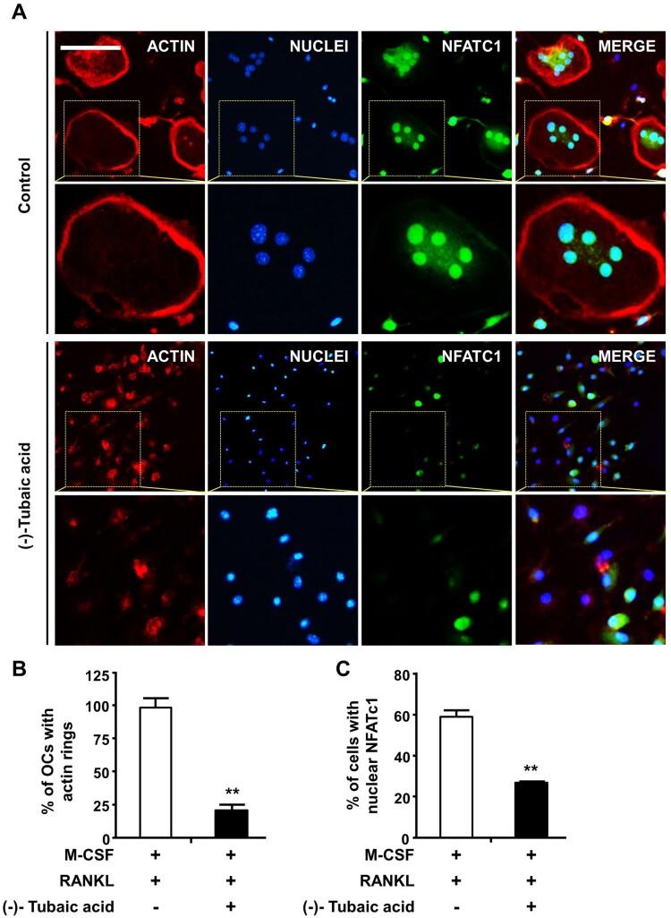 https://cdn.ncbi.nlm.nih.gov/pmc/blobs/ff7c/9873279/0e68e32b2635/TACS_A_2166107_F0003_OC.jpg