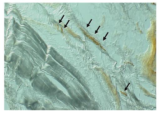 https://cdn.ncbi.nlm.nih.gov/pmc/blobs/ff81/5620400/37a3684d9c5c/TOORTHJ-11-687_F1.jpg