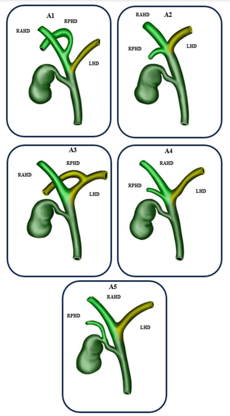 https://cdn.ncbi.nlm.nih.gov/pmc/blobs/ff86/11118781/e4c58cd1c436/cureus-0016-00000058905-i01.jpg