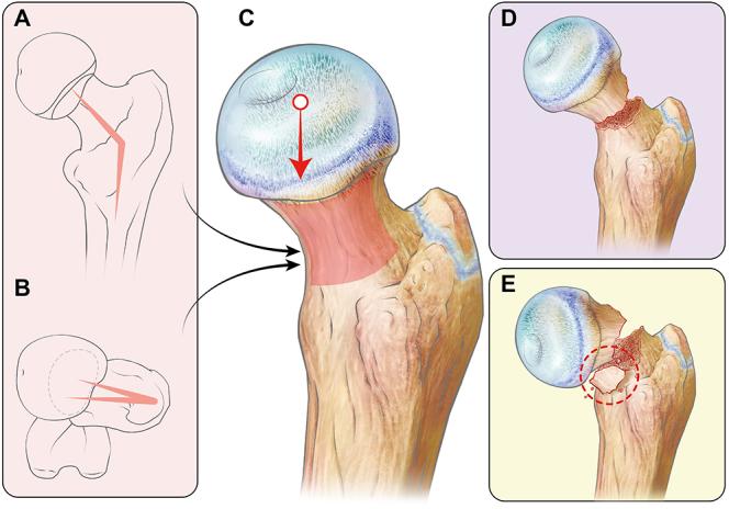 https://cdn.ncbi.nlm.nih.gov/pmc/blobs/ff87/11896687/181088d0d3ad/EOR-2024-0129fig1.jpg