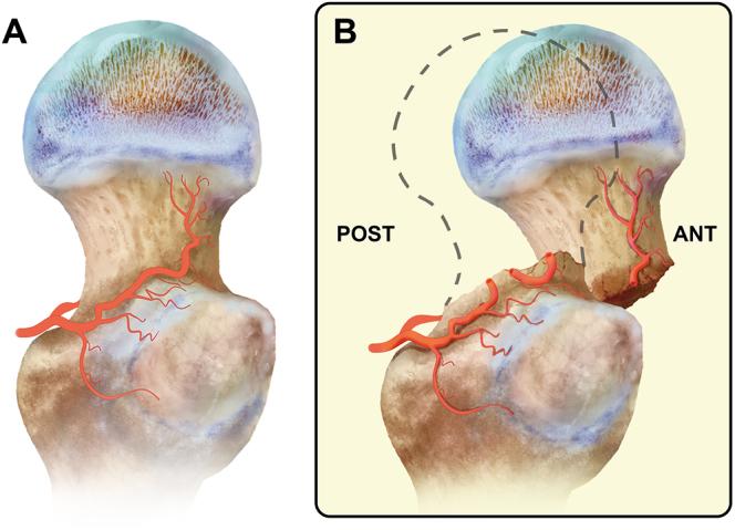 https://cdn.ncbi.nlm.nih.gov/pmc/blobs/ff87/11896687/597a77a2b228/EOR-2024-0129fig2.jpg