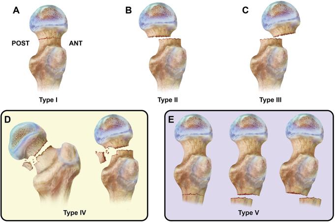 https://cdn.ncbi.nlm.nih.gov/pmc/blobs/ff87/11896687/6c2c21e2ad3a/EOR-2024-0129fig3.jpg
