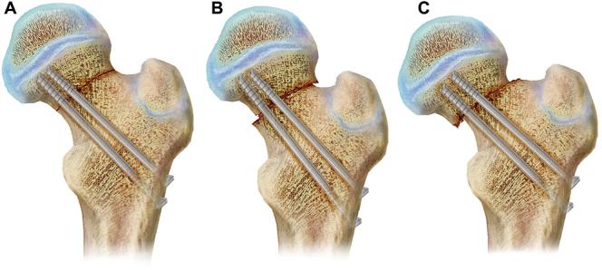 https://cdn.ncbi.nlm.nih.gov/pmc/blobs/ff87/11896687/e84a0af90bca/EOR-2024-0129fig10.jpg