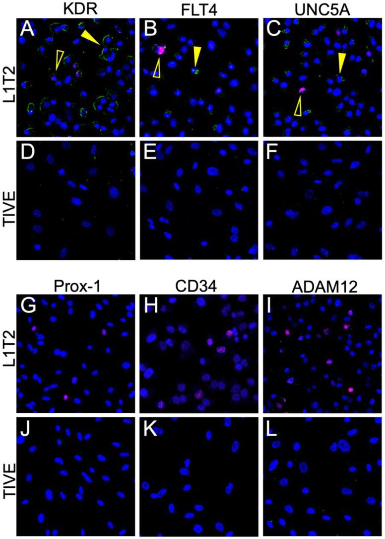 https://cdn.ncbi.nlm.nih.gov/pmc/blobs/ff89/10093722/7dacd13e9ddc/cancers-15-02171-g006.jpg