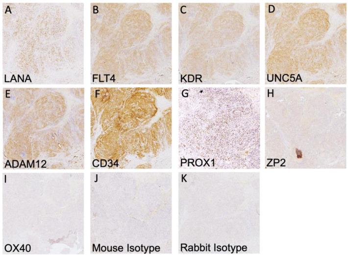 https://cdn.ncbi.nlm.nih.gov/pmc/blobs/ff89/10093722/96964c9f7299/cancers-15-02171-g002.jpg