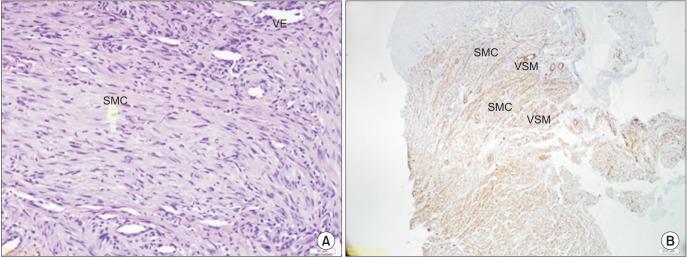 https://cdn.ncbi.nlm.nih.gov/pmc/blobs/ff8a/4860377/8b832029d797/jkaoms-42-115-g003.jpg
