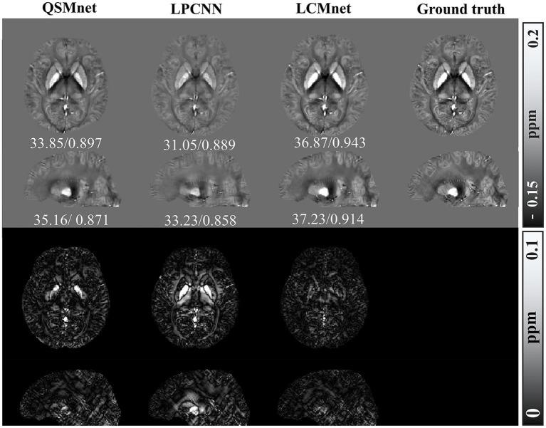https://cdn.ncbi.nlm.nih.gov/pmc/blobs/ff91/10771344/63585f629907/fnins-17-1308829-g009.jpg