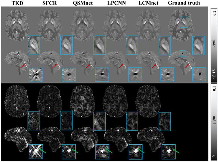 https://cdn.ncbi.nlm.nih.gov/pmc/blobs/ff91/10771344/eb7829a101ef/fnins-17-1308829-g007.jpg