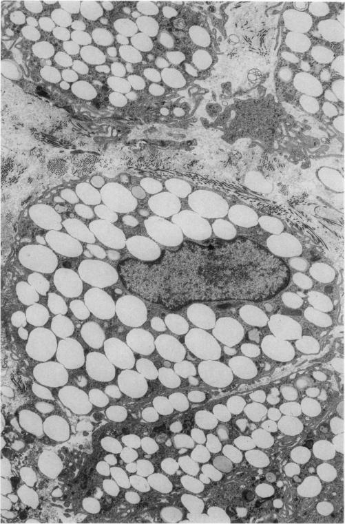 https://cdn.ncbi.nlm.nih.gov/pmc/blobs/ff96/1915033/4bb899520e54/amjpathol00464-0152-a.jpg