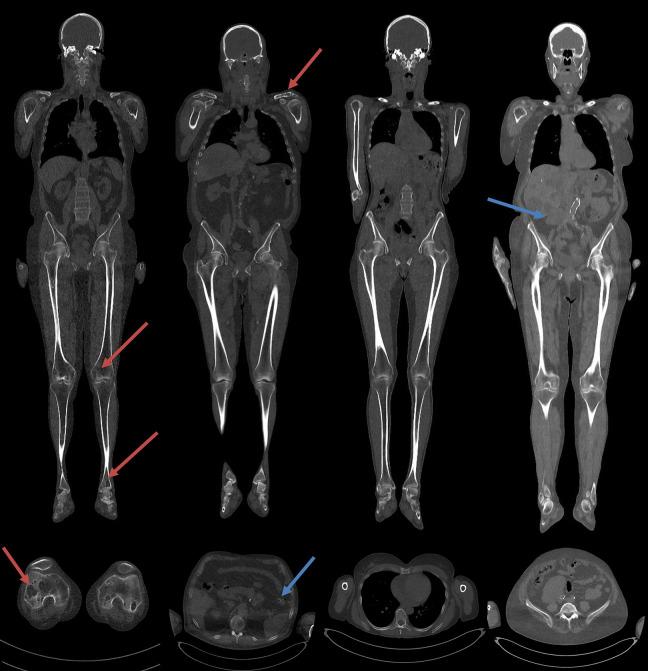 https://cdn.ncbi.nlm.nih.gov/pmc/blobs/ff9b/7783892/8e723bec43b3/10.1177_1559325820973131-fig1.jpg