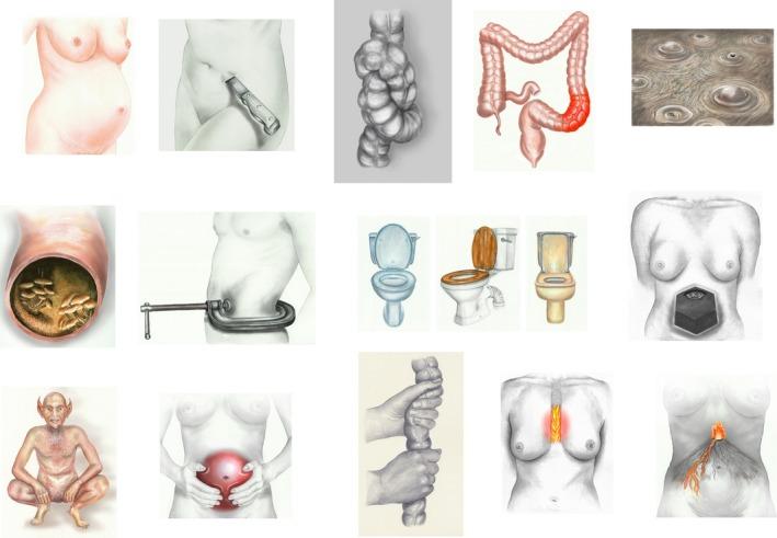https://cdn.ncbi.nlm.nih.gov/pmc/blobs/ff9f/6850508/4b5924acffa0/NMO-31-na-g001.jpg