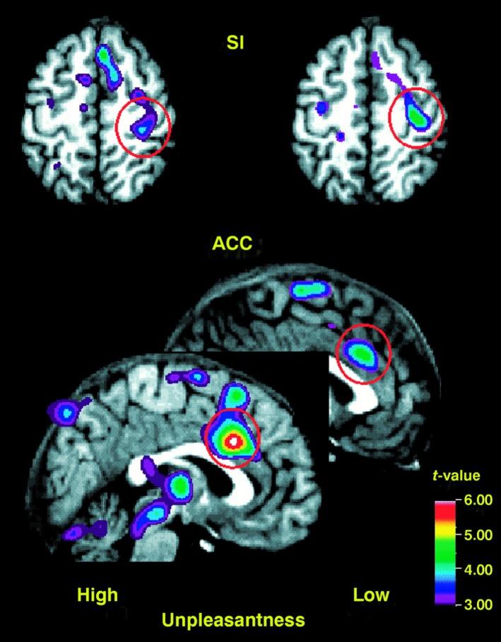https://cdn.ncbi.nlm.nih.gov/pmc/blobs/ff9f/6850508/f242ef9c317e/NMO-31-na-g002.jpg