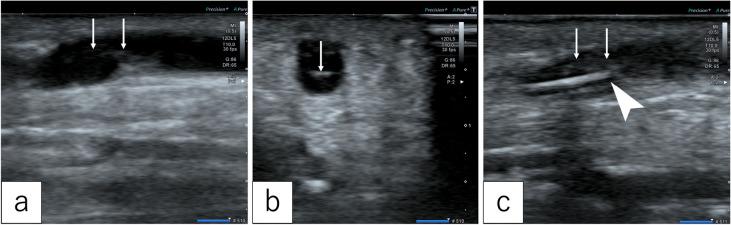 https://cdn.ncbi.nlm.nih.gov/pmc/blobs/ffa2/11570216/0443ce798873/2432-0935-9-3-0164-g001.jpg
