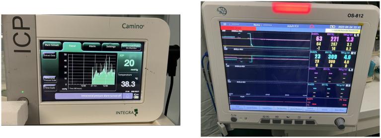 https://cdn.ncbi.nlm.nih.gov/pmc/blobs/ffab/11303234/043f1250c74d/fneur-15-1406157-g002.jpg