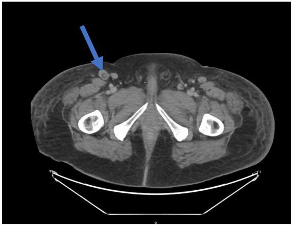 https://cdn.ncbi.nlm.nih.gov/pmc/blobs/ffb2/7926050/e9b822a6f6b0/10.1177_2324709621997282-fig1.jpg