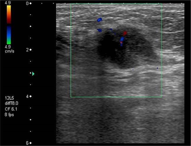 https://cdn.ncbi.nlm.nih.gov/pmc/blobs/ffb3/5268370/e340e8352d8d/jhc-4-023Fig2.jpg
