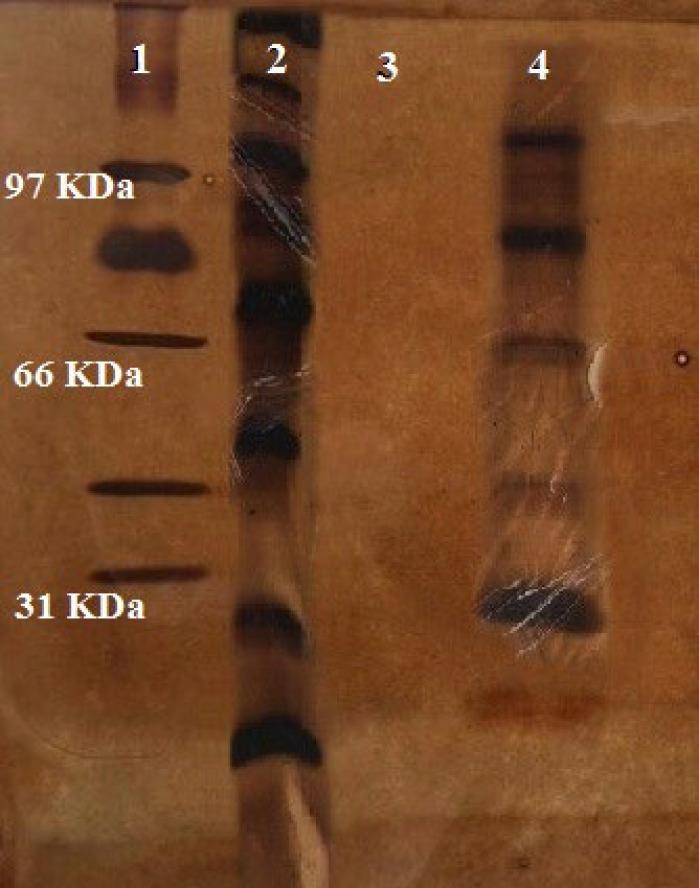 https://cdn.ncbi.nlm.nih.gov/pmc/blobs/ffb6/11790195/88aa5897abe7/IJBMS-28-347-g002.jpg
