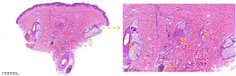 https://cdn.ncbi.nlm.nih.gov/pmc/blobs/ffb8/12151158/f043c4a7f899/CCID-18-1431-g0003.jpg