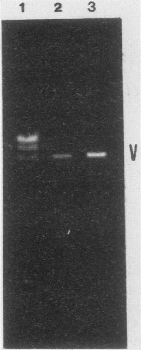 https://cdn.ncbi.nlm.nih.gov/pmc/blobs/ffba/360806/796b902dd12e/molcellb00043-0384-a.jpg