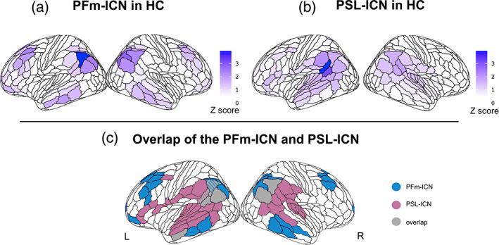 https://cdn.ncbi.nlm.nih.gov/pmc/blobs/ffbe/10318204/84511529e7cc/HBM-44-4390-g001.jpg