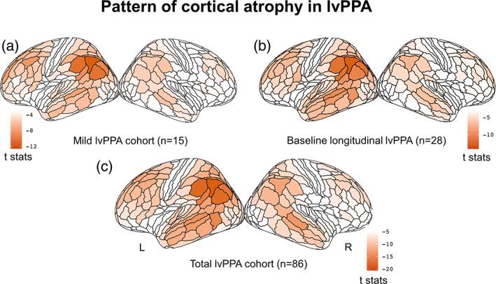 https://cdn.ncbi.nlm.nih.gov/pmc/blobs/ffbe/10318204/9342ce12f565/HBM-44-4390-g003.jpg