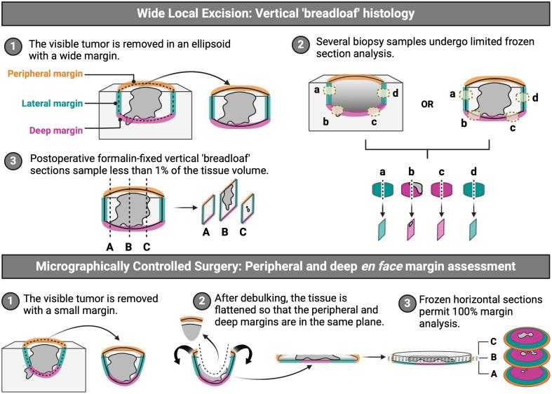 https://cdn.ncbi.nlm.nih.gov/pmc/blobs/ffbe/12048172/38b95a1658b9/JBO-030-S13711-g001.jpg
