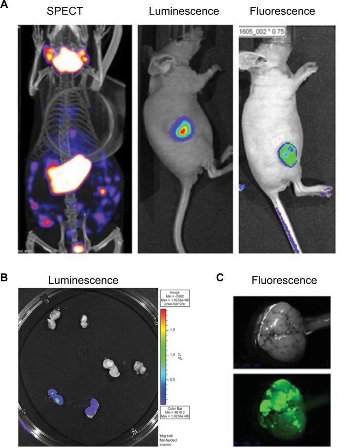 https://cdn.ncbi.nlm.nih.gov/pmc/blobs/ffbf/5880516/5bde835e7a43/ov-7-025Fig2.jpg