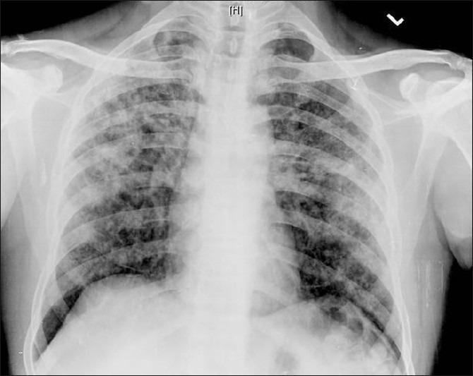 https://cdn.ncbi.nlm.nih.gov/pmc/blobs/ffc8/3342731/c09a533addc5/IJMPO-32-180-g002.jpg
