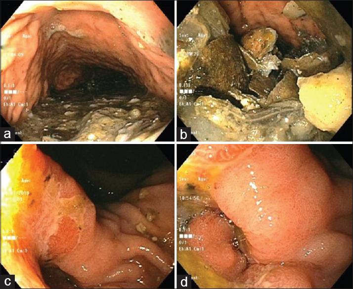 https://cdn.ncbi.nlm.nih.gov/pmc/blobs/ffcd/7380801/20285d6cbcd0/JFMPC-9-2558-g002.jpg