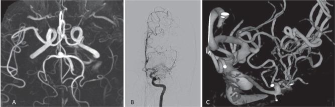 https://cdn.ncbi.nlm.nih.gov/pmc/blobs/ffd4/5495957/57f8d7e4b803/nmc-57-261-g4.jpg