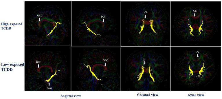 https://cdn.ncbi.nlm.nih.gov/pmc/blobs/ffd8/11079160/075e41a0b15b/fnins-18-1344653-g004.jpg