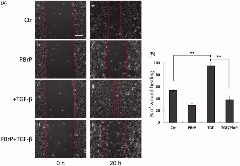 https://cdn.ncbi.nlm.nih.gov/pmc/blobs/ffe4/6009923/1d7e1b607451/IENZ_A_1465416_F0004_C.jpg